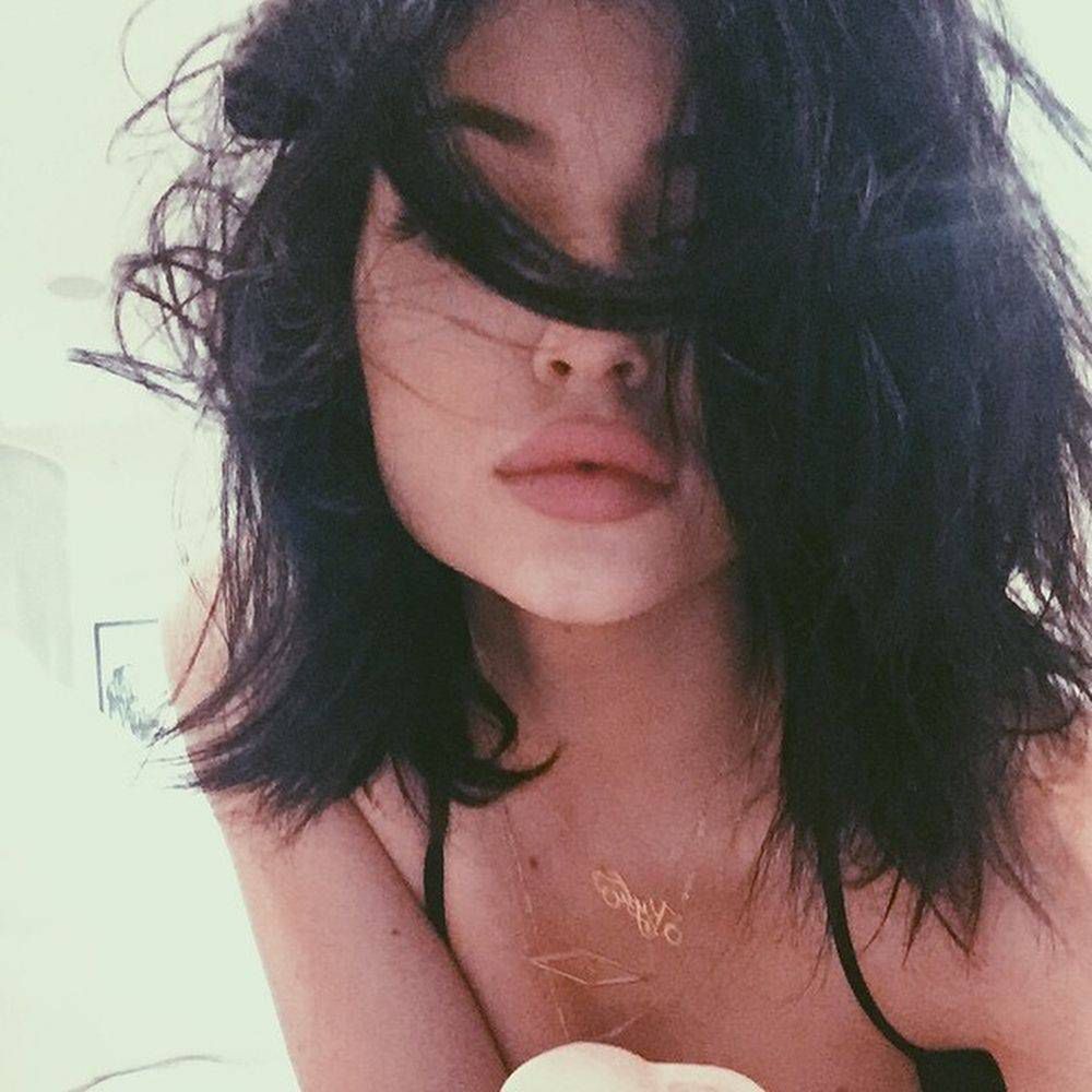 Kylie Jenner po operacji