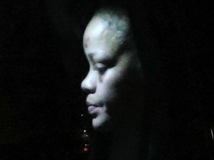 Rihanna siniaki na twarzy