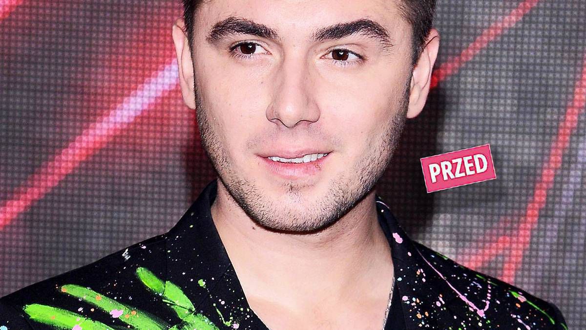 Kamil Bednarek - metamorfoza. Jak się zmienił?