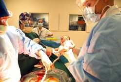 "Wydobyciny" to nie urodziny. Kobiety atakują kobiety, które rodziły przez cesarskie cięcie