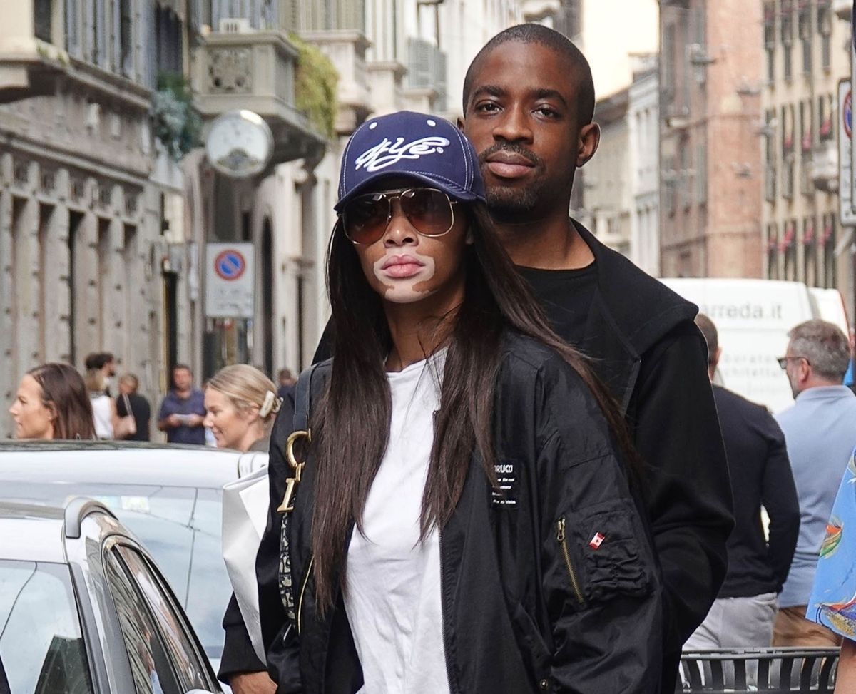 Kanadyjska modelka Winnie Harlow w ogniu krytyki