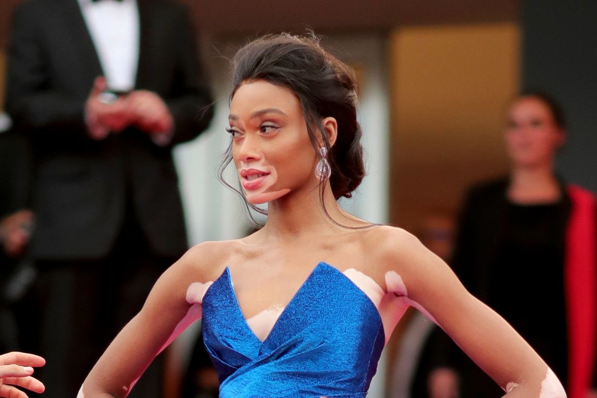 Winnie Harlow na czerwonym dywanie w Cannes [FOTO]