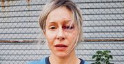 Katarzyna Warnke na zdjęciu Patryka Vegi. Mrozi krew w żyłach
