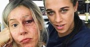 "Pobita" Katarzyna Warnke. Pokazała się ze znaną mistrzynią MMA