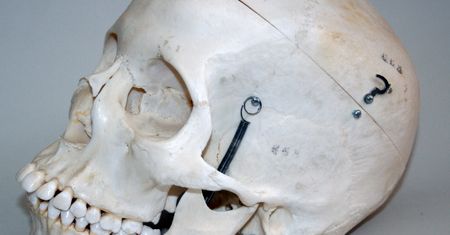 Dwie czaszki ponad 70 lat leżały w szafie niemieckiego lekarza. Eksperci ustalą do kogo należały?