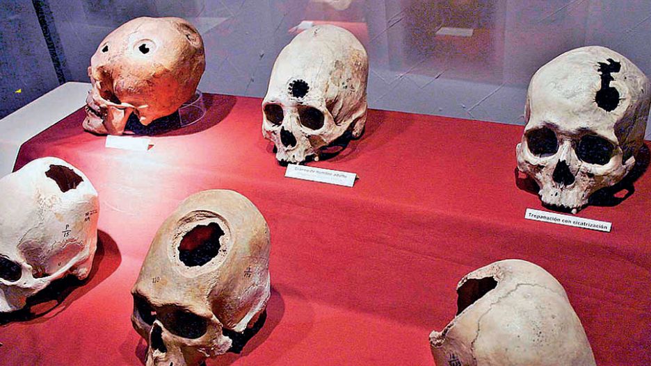 Inkowie byli prawdziwymi mistrzami w dziedzinie chirurgii, szczególnie podczas wykonywania tak zwanej trepanacji czaszki