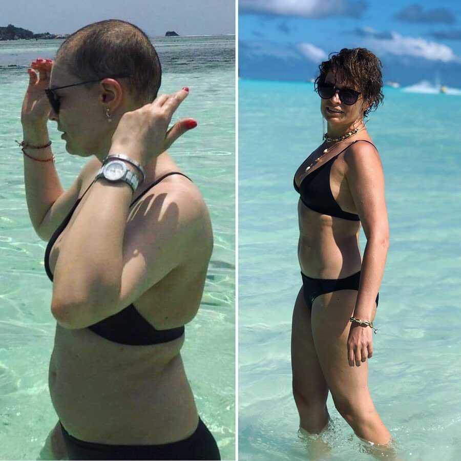 Joanna Górska w bikini w trakcie chemioterapii i rok później