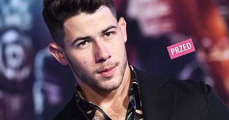 Nick Jonas zmienił fryzurę. Postawił na odważne cięcie. Internauci są pod wrażeniem: "Jesteś taki przystojny"