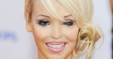 Katie Piper: wstrząsająca historia prezenterki poparzonej kwasem