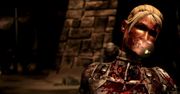 Twórcy Mortal Kombat X mają problem z gwiazdą UFC