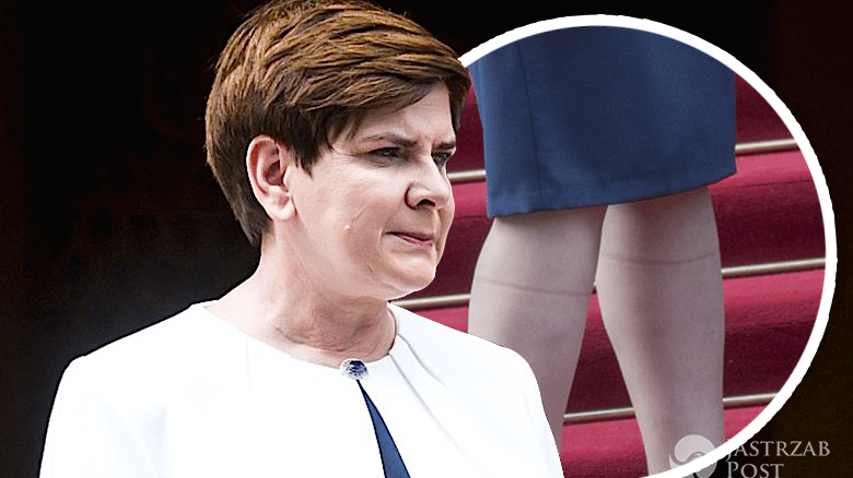 Beata Szydło ze śladami po podkolanówkach na nogach