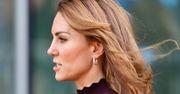 Księżna Kate ma bliznę na głowie. Temat znów zainteresował jej fanów