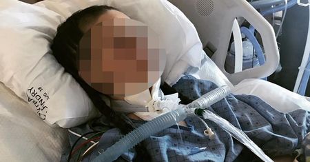 13-latka osłoniła ciałem niemowlę. Jest w ciężkim stanie