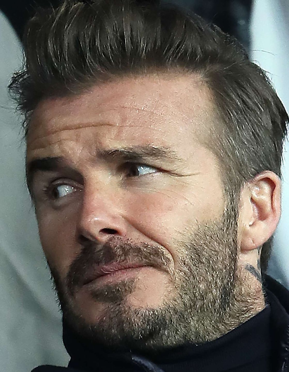 David Beckham przed przeszczepem włosów