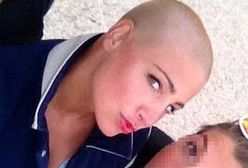 Laura Samojłowicz ogoliła się na łyso!