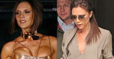 Victoria Beckham: "Usunęłam implanty"!