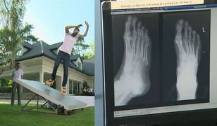 "Top Model" programem wysokiego ryzyka. Dlaczego producenci ryzykują zdrowie uczestników?