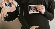 Gwiazda serialu TVN ogłosiła radosne wieści. Uroczą sesją przekazała, że jest w ciąży. Długo trzymała to w tajemnicy