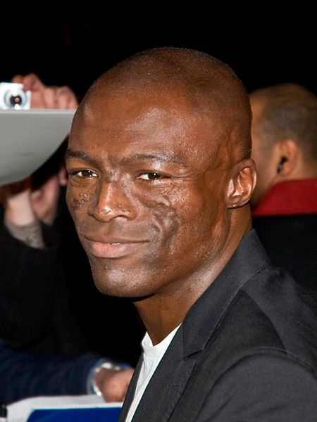 Seal - blizny po toczniu