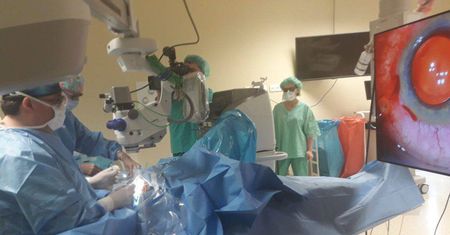 Operacja oka na dużym ekranie. Nowoczesny sprzęt w szpitalu klinicznym w Lublinie