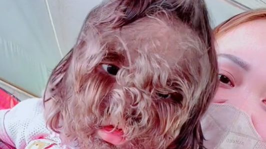 Pielęgniarka zemdlała na porodówce. Przestraszyła się wyglądu dziecka