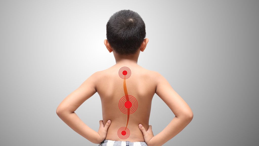 Skoliozę warto leczyć, jak tylko dostrzeżemy jej pierwsze objawy