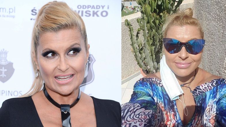 Katarzyna Skrzynecka odpiera zarzuty dotyczące majstrowania przy twarzy