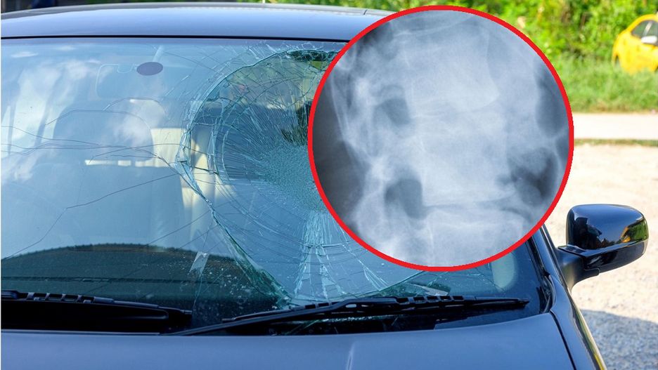 Lekarze z Gdańska uratowali 3-latkę z oderwaną głową