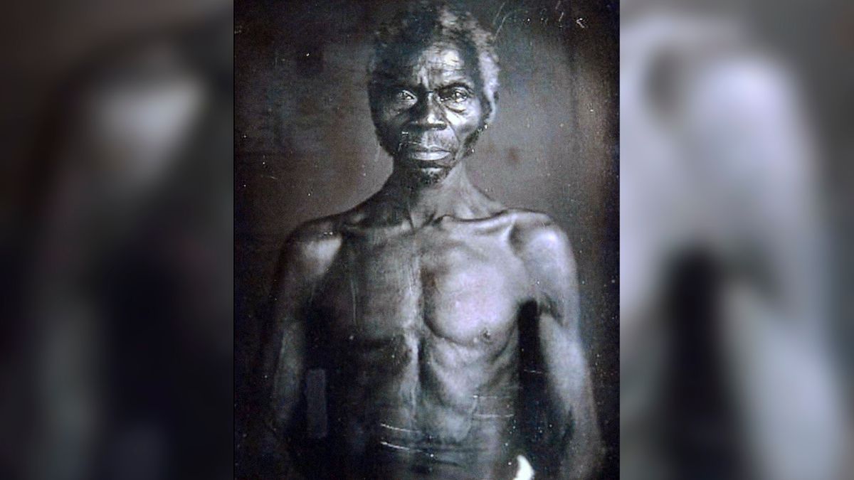 Harvard pozwany za czerpanie korzyści ze zdjęć niewolników z 1850 roku 1