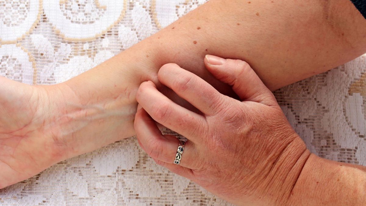 Niedobór witaminy B12 - objawy, przyczyny, rozpoznanie, leczenie