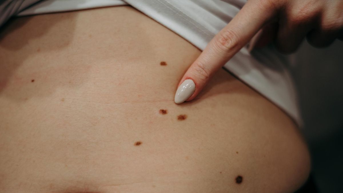 Sprawdzaj swoje ciało co kilka tygodni