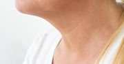 Masz "naszyjnik Wenus"? Oto zabiegi, które odmłodzą szyję o kilka lat