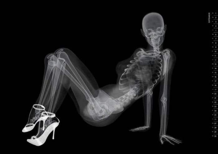 X-ray Pin-up Girls