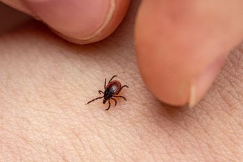 Jak odstraszać kleszcze? Te sposoby działają