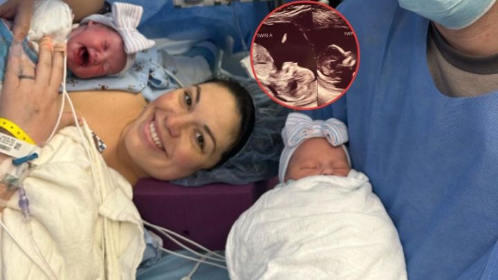 Niezwykłe bliźniaczki