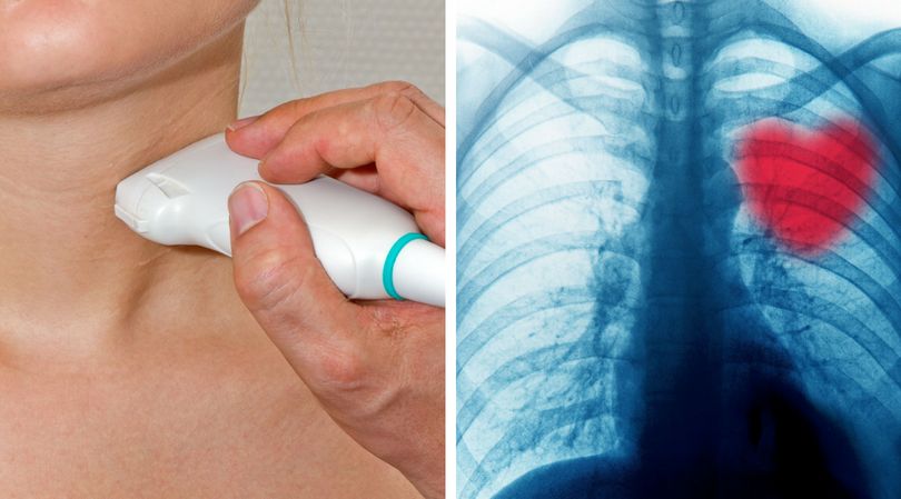 5 objawów, które mogą świadczyć o problemach z tarczycą. Lepiej ich nie ignoruj!