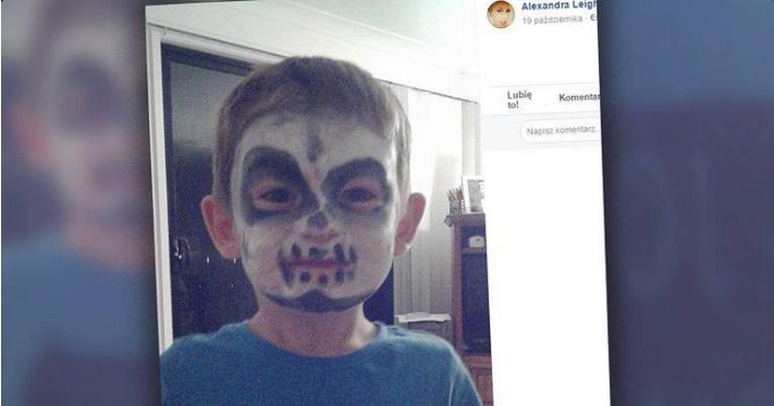 Przebranie na Halloween zrobiło dziecku krzywdę. 4-latek doznał poparzenia twarzy