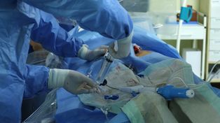 Pierwszy przeszczep szpiku w Polsce. Mija 41 lat