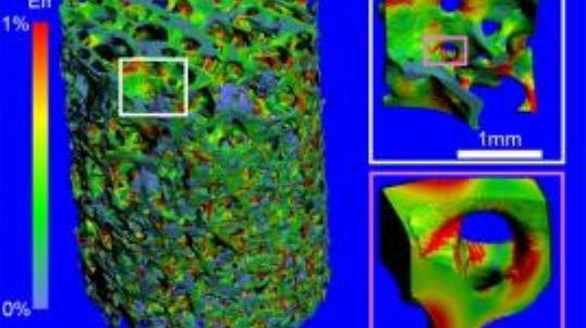 Superkomputer IBM pomoże w leczeniu osteoporozy 1