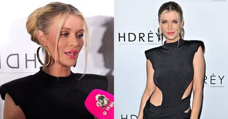 Joanna Krupa robiła zabiegi na twarz, mając 20 lat: "Bardzo żałuję, że wtedy próbowałam takich rzeczy, bo ich nie potrzebowałam"