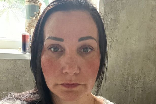 Kelly przez lata zmagała się z potwornym bólem