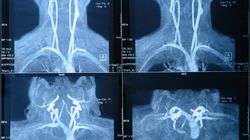 Rezonans magnetyczny szyi - wskazania, przygotowanie, cena
