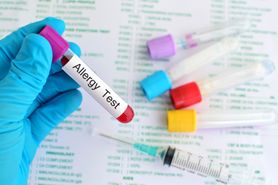 Testy alergiczne z krwi - przebieg badania, wady i zalety