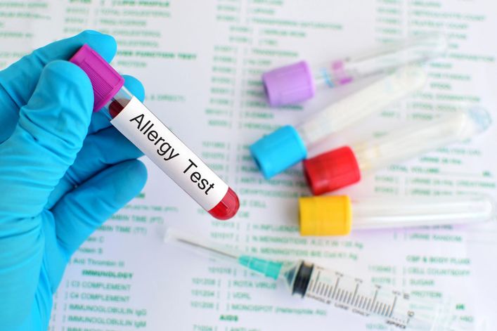 Testy alergiczne z krwi