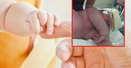 Ważył ponad 7 kg. Niezwykły poród w Brazylii