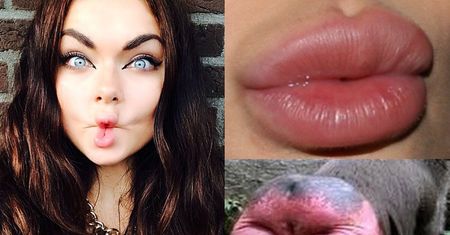 Luxuria odpowiada Gojdziowi na "USTA JAK ODBYT": "Zadaniem lekarza jest pomagać, a nie szkodzić!"