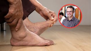 Przyczyna dny moczanowej. "Ten mit trzeba obalić"