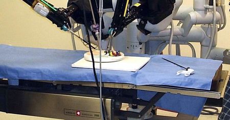 Szokujące kulisy operacji robotycznych: Pacjenci skarżą się na poważne powikłania!