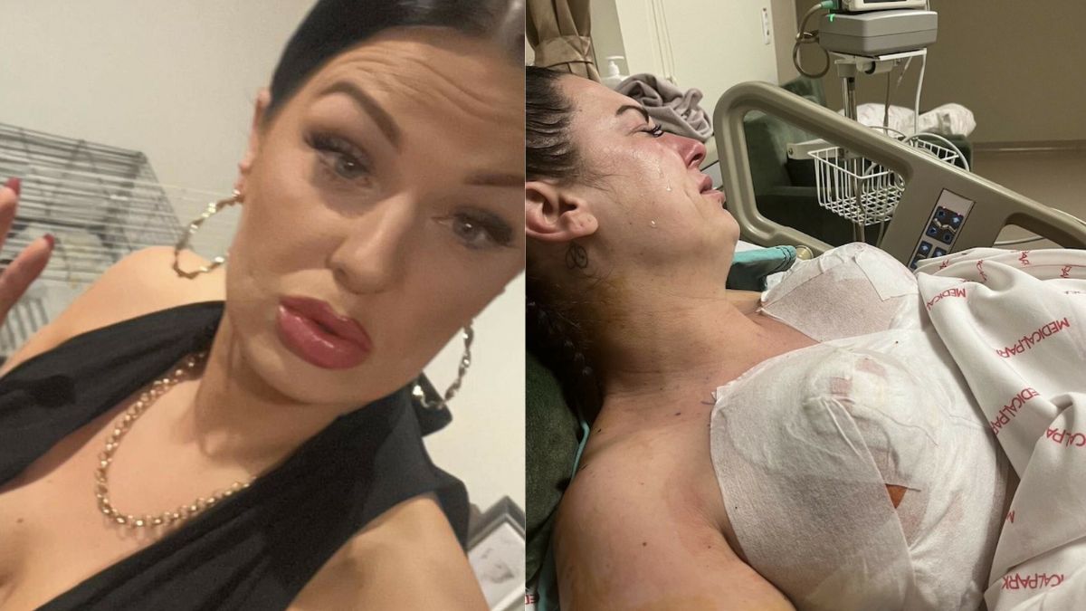 Nieudana operacja w Turcji