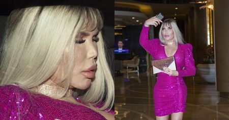 "Żywy Ken" i jego nowy biust debiutują w tureckim hotelu (FOTO)